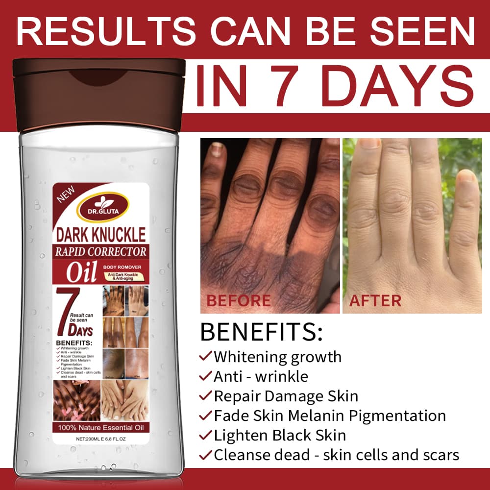 Dark Knuckle Body Oil Anti Dark Knuckle & Anti Aging Whitening Oil Skin Care 200ml