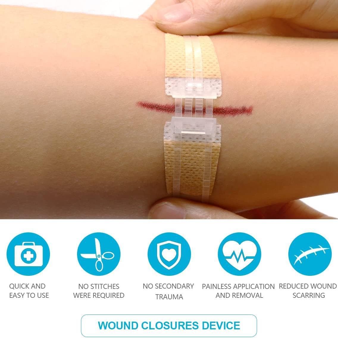 Non-woven Zipper Skin Stapler Wound Suture Patch Pull Self-adhesive Bandage